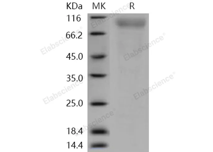 Recombinant Human CD180/RP105/LY64 Protein (His Tag) - image 1