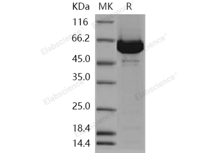 Recombinant Human ACOX1/aox Protein (His Tag) - image 1