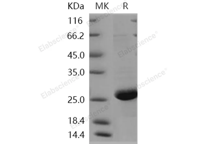 Recombinant Human CRP/C-Reactive Protein - image 1