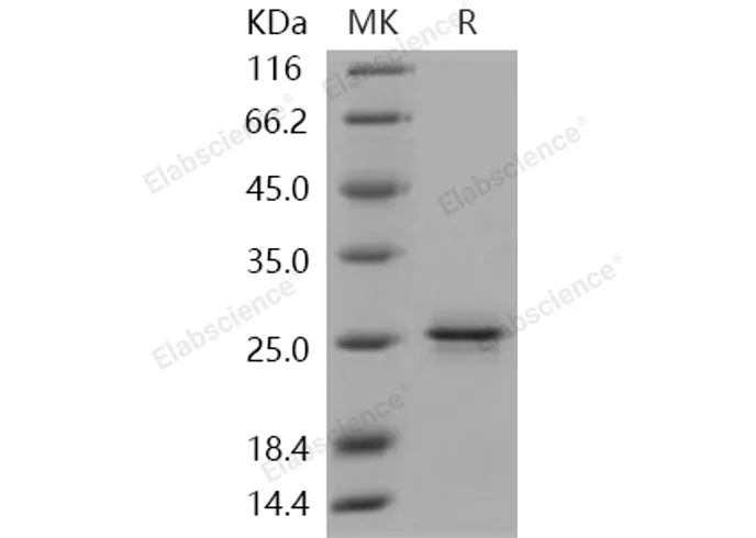 Recombinant Human PRDM2/RIZ1 Protein - image 1