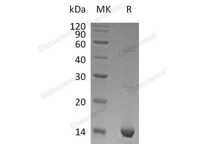 Recombinant Human S100A9 Protein - image 1