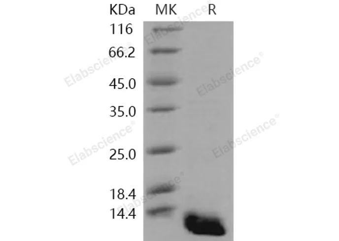 Recombinant Human S100A8 Protein (E.coli, His Tag) - image 1