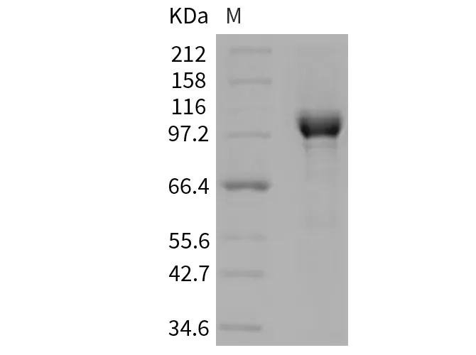 Recombinant Human PARP-1 Protein (His Tag) - image 1