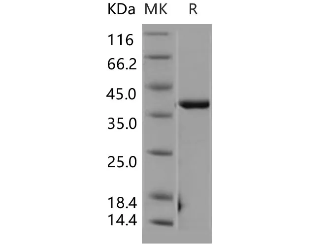 Recombinant Human CSNK2A2/CK2A2 Protein - image 1