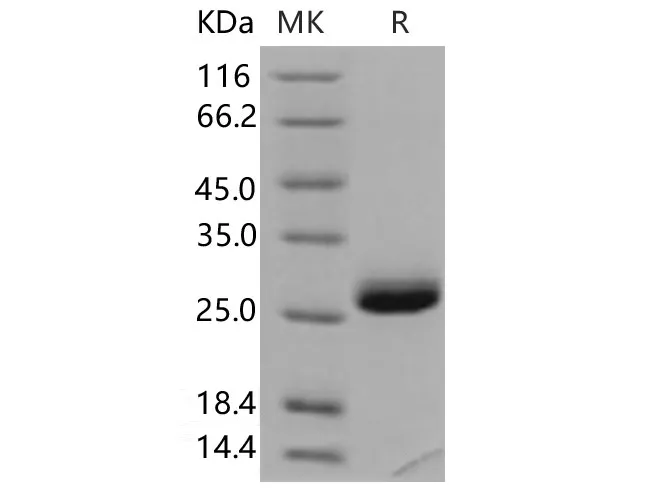 Recombinant Human TIMP-1/TIMP1 Protein - image 1