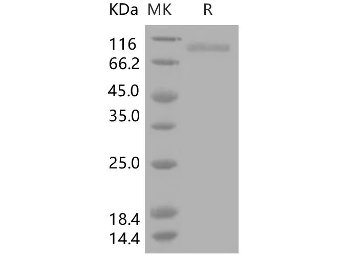 Recombinant Human CD10/Neprilysin Protein - image 1
