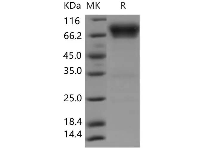Recombinant Human B7-H4/VTCN1 Protein (Fc Tag) - image 1