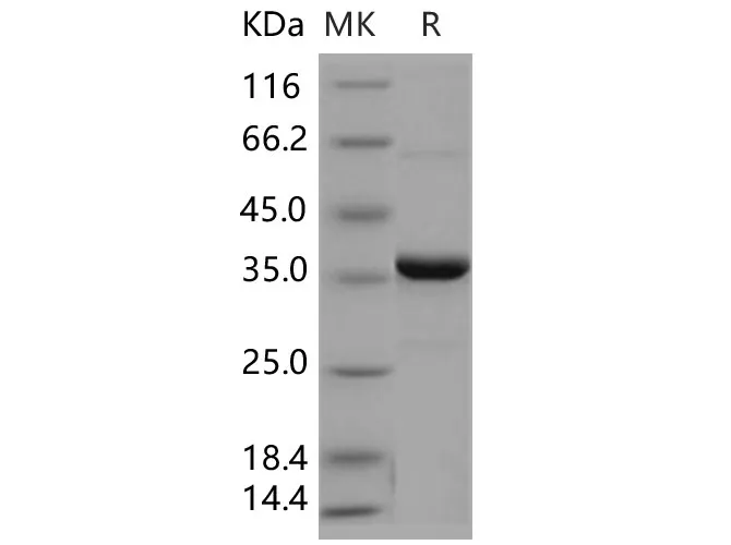 Recombinant Human PTPN2/PTPT Protein - image 1