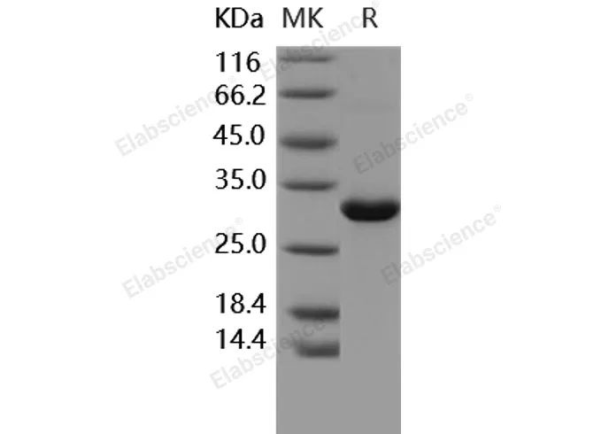 Recombinant Human MBL2/MBL/COLEC1 Protein - image 1