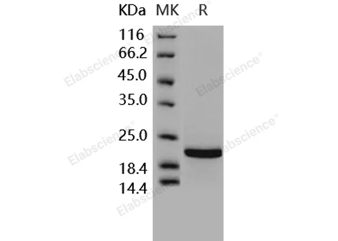 Recombinant Human TIMP2/TIMP-2 Protein - image 1