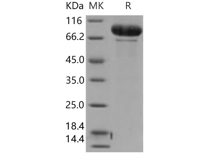 Recombinant Human MMP-9 Protein - image 1