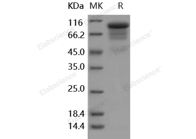 Recombinant Human G-CSFR/CD114 Protein - image 1
