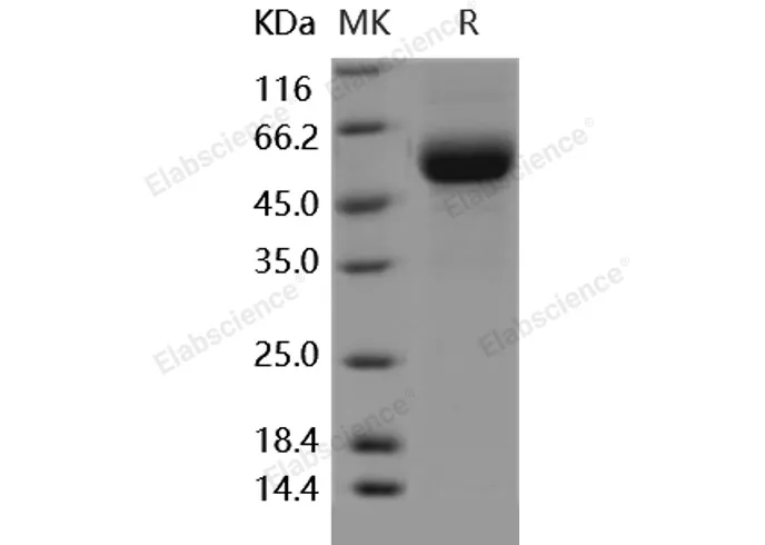 Recombinant Human DDR2 Kinase/CD167b Protein (His Tag) - image 1