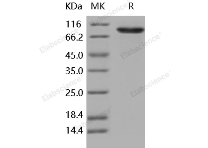Recombinant Human DDR2 Kinase/CD167b Protein (Fc Tag) - image 1