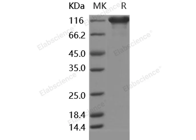 Recombinant Human ACE2 Protein (Fc Tag) - image 1