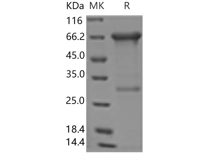 Recombinant Human MMP-2 Protein - image 1