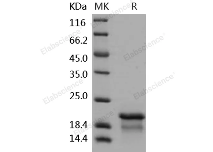 Recombinant Human NPM1/Nucleophosmin Protein (His Tag) - image 1