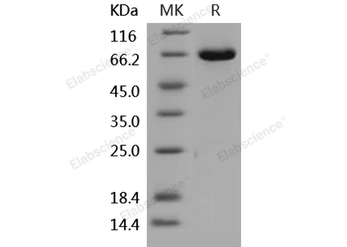 Recombinant Human ERK2/MAPK1/MAPK2 Protein (GST Tag) - image 1