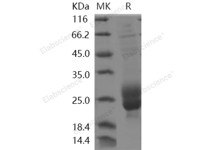 Recombinant Human M-CSF/CSF1 Protein - image 1
