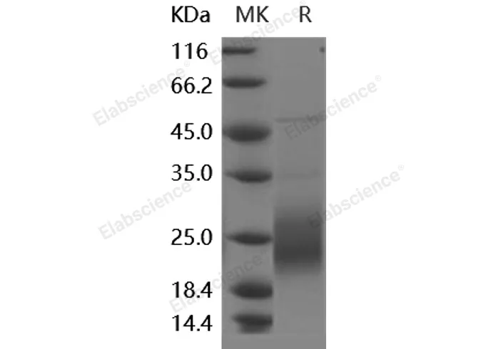 Recombinant Human GM-CSF/CSF2 Protein (HEK293 Cells) - image 1