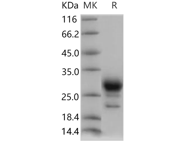 Recombinant Human PGD2 Synthase/PTGDS Protein (His Tag) - image 1