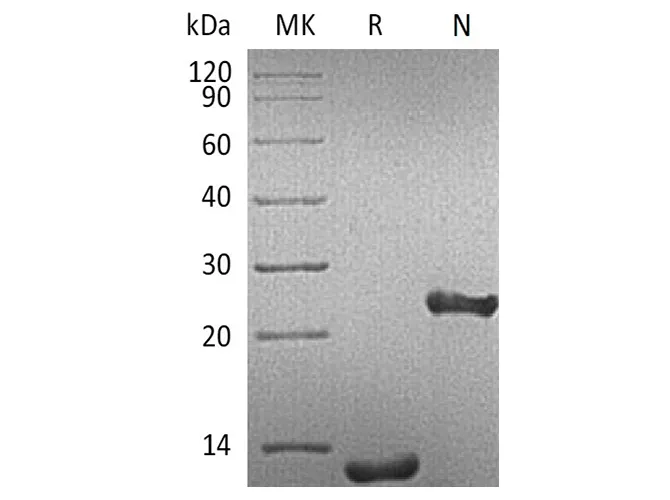 Recombinant Human TGFB1/TGF-beta 1 Protein - image 1