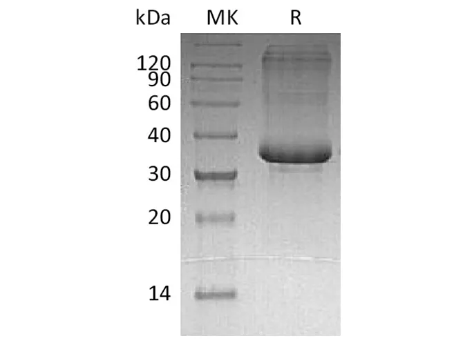 Recombinant Human SP-10/ACRV1 Protein (His Tag) - image 1