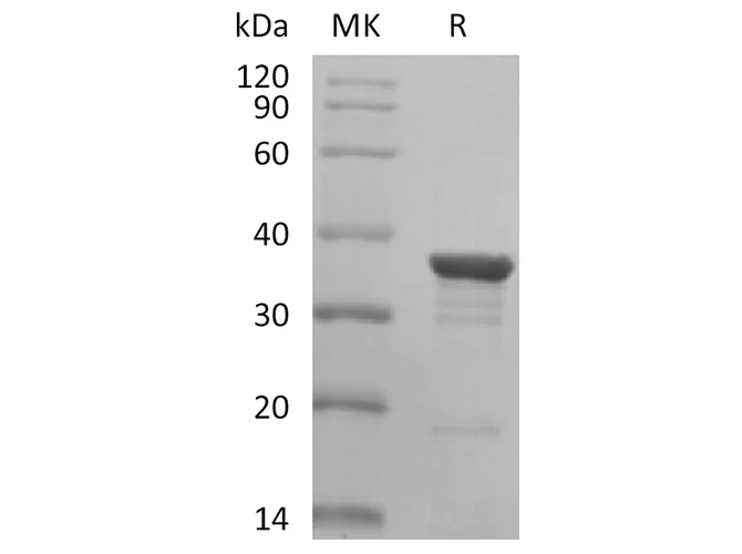Recombinant Human AKR1C2 Protein - image 1