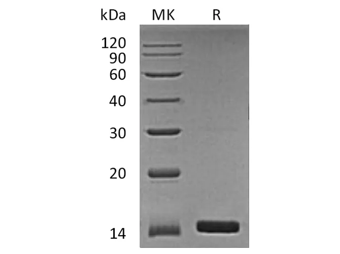 Recombinant Human Angiogenin/ANG Protein - image 1
