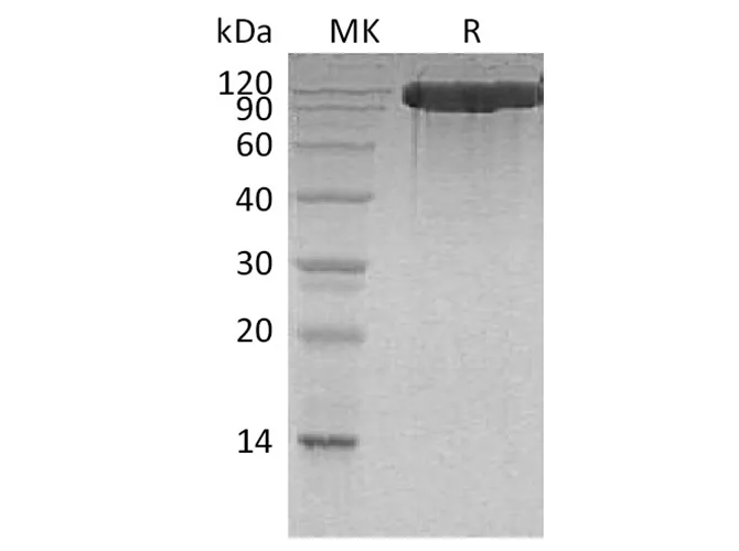 Recombinant Human ACE2 Protein (His Tag) - image 1