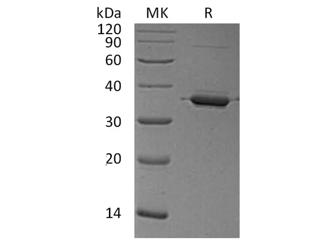 Recombinant Human Annexin A2/ANXA2 Protein - image 1