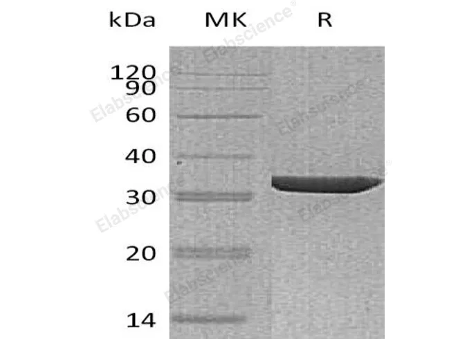 Recombinant Human Annexin A3/ANXA3 Protein - image 1