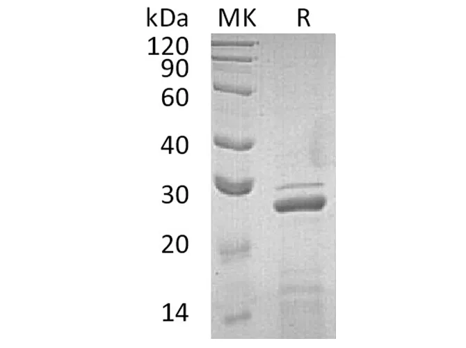 Recombinant Human Apolipoprotein A-I/ApoAI Protein - image 1