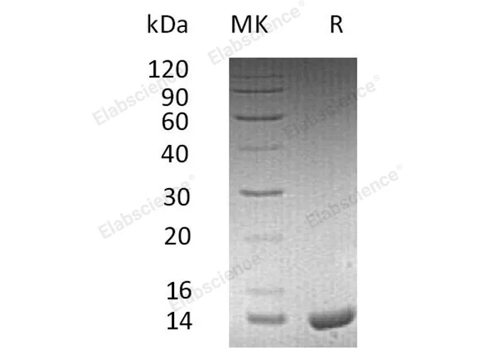 Recombinant Human Apolipoprotein C-II/APOC2 Protein (His Tag) - image 1