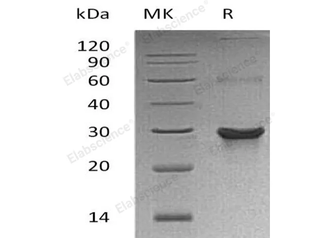 Recombinant Human ATG10 Protein (His&T7 Tag) - image 1