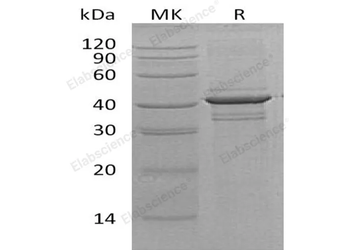 Recombinant Human Calreticulin-3/CALR3 Protein - image 1