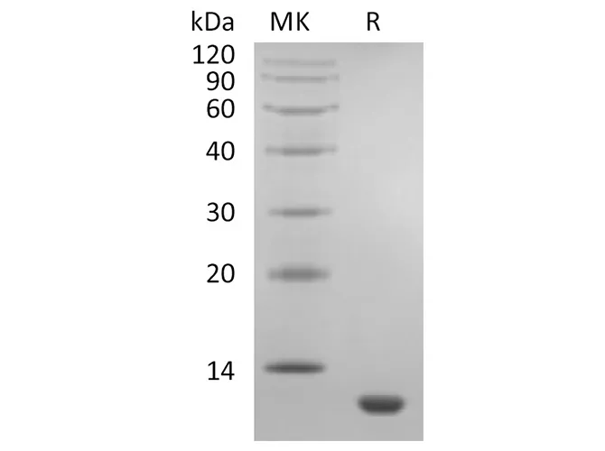 Recombinant Human CCL11/Eotaxin Protein - image 1