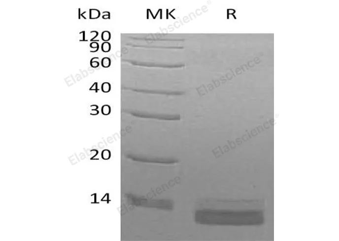 Recombinant Human CCL14/HCC-3 Protein (His Tag) - image 1