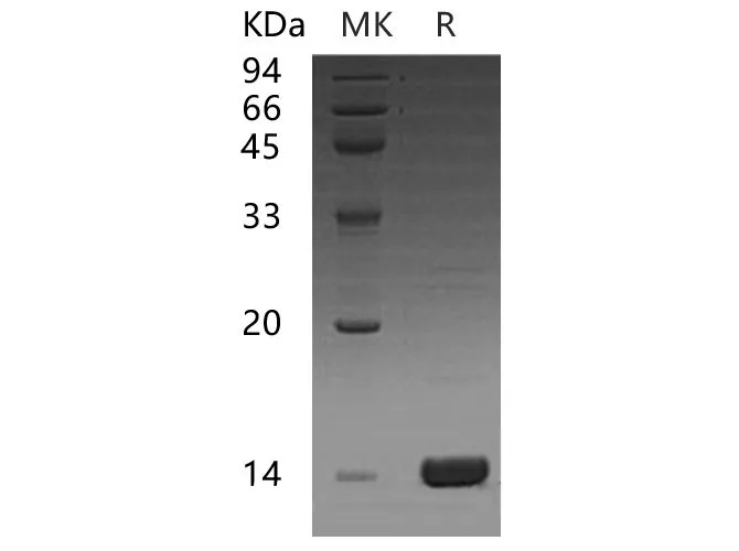 Recombinant Human CCL16 Protein - image 1