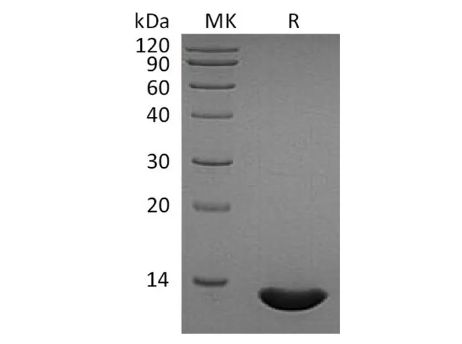 Recombinant Human CCL2/MCP-1 Protein - image 1