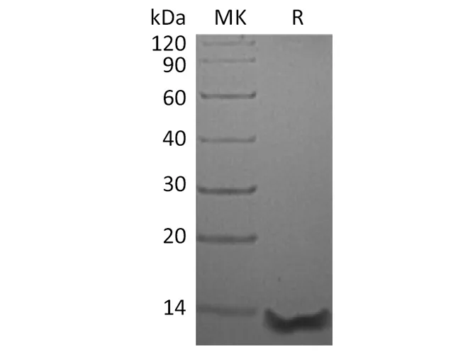 Recombinant Human Eotaxin-3/CCL26 Protein (aa 27-94) - image 1