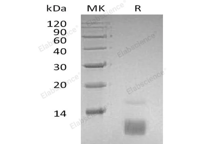 Recombinant Human CCL5/RANTES Protein - image 1