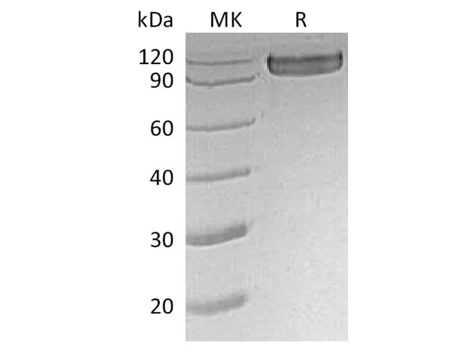 Recombinant Human CD30/TNFRSF8 Protein (Fc Tag) - image 1