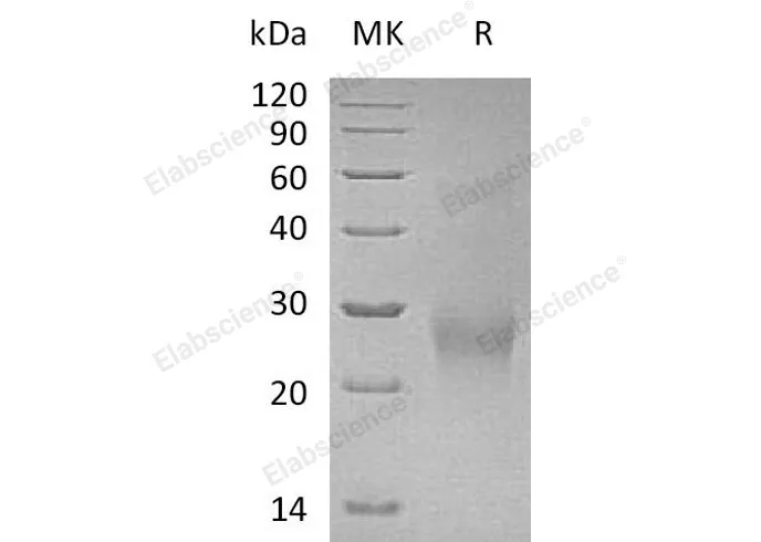 Recombinant Human CDK2AP2 Protein (Human Cells, His Tag) - image 1