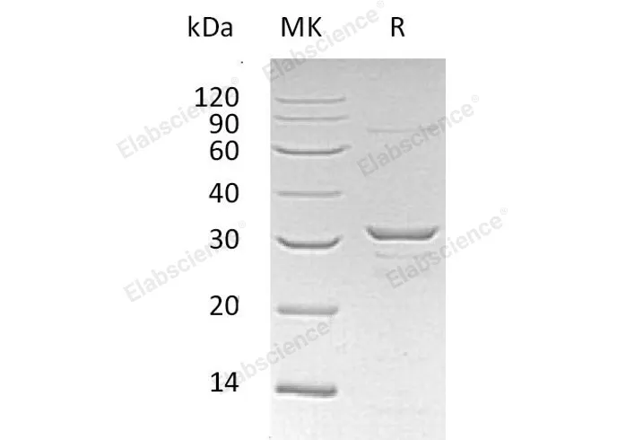 Recombinant Human CLIC1 Protein (His Tag) - image 1