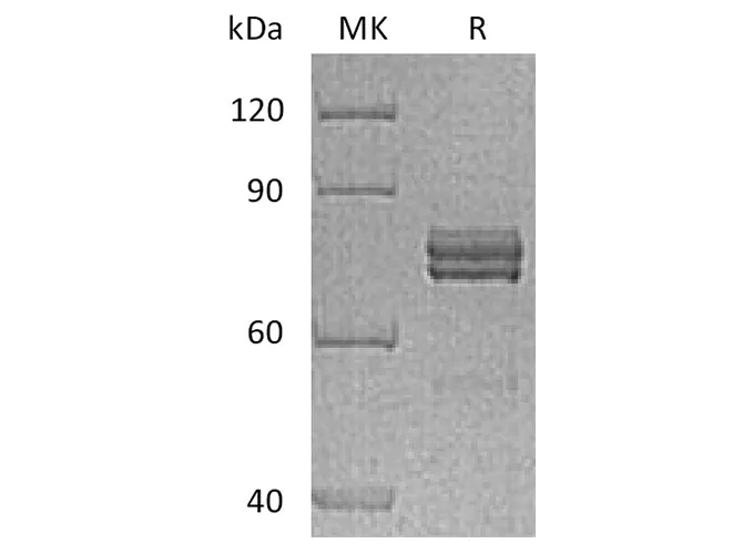 Recombinant Human CTGF/CCN2 Protein (Fc Tag) - image 1