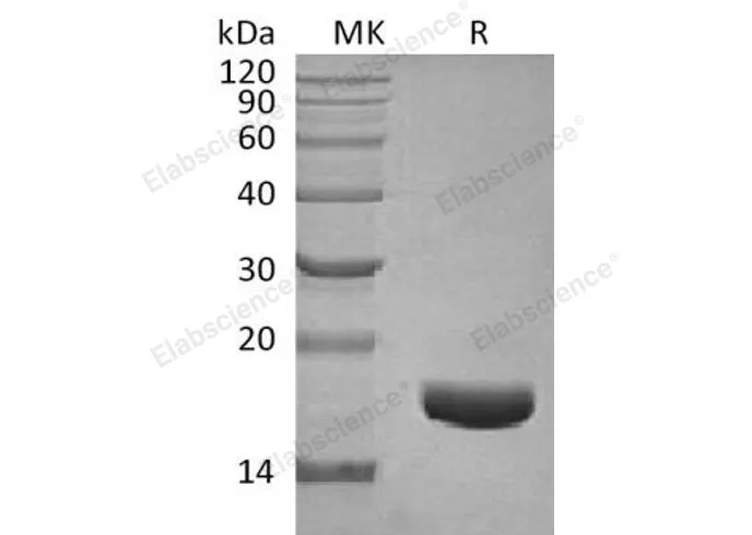 Recombinant Human CTGF/CCN2 Protein - image 1
