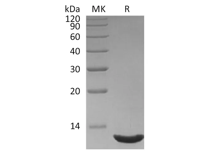Recombinant Human CXCL12/SDF-1 Protein (aa19-93) - image 1