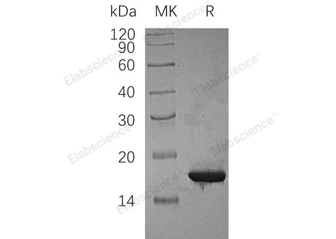 Recombinant Human CDKN2C Protein (His Tag) - image 1