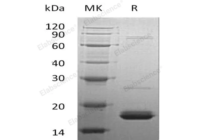Recombinant Human Cytochrome b5/CYB5A Protein (His Tag) - image 1